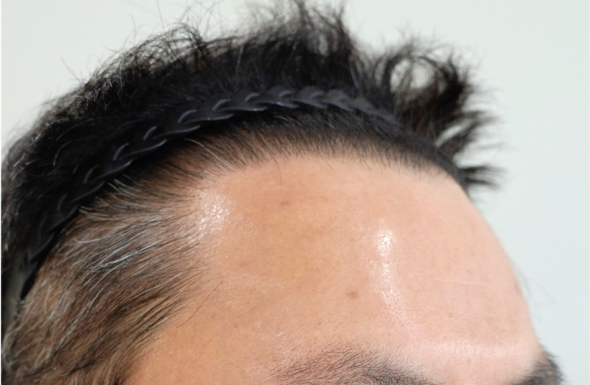 after